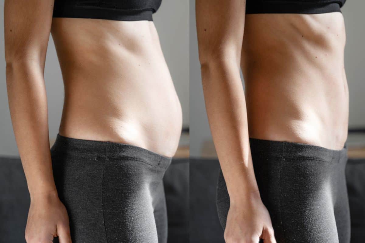 Post-Pregnancy: What Happens to Your Abdominal Muscles After Birth Stratford