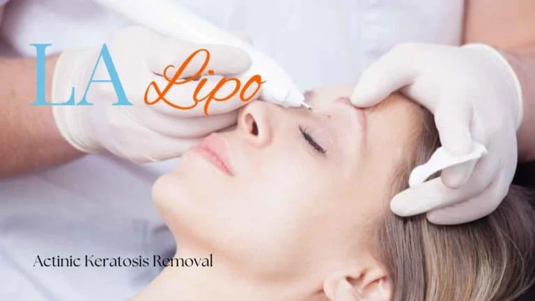 Woman receiving Actinic Keratosis Removal Treatment Stratford