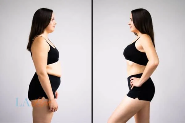 link between body image and mental health Stratford