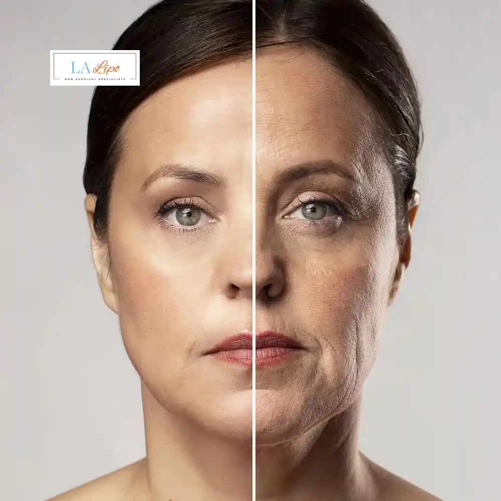 How Can You Tell If Non-Surgical Skin Tightening Is Right for You Stratford?