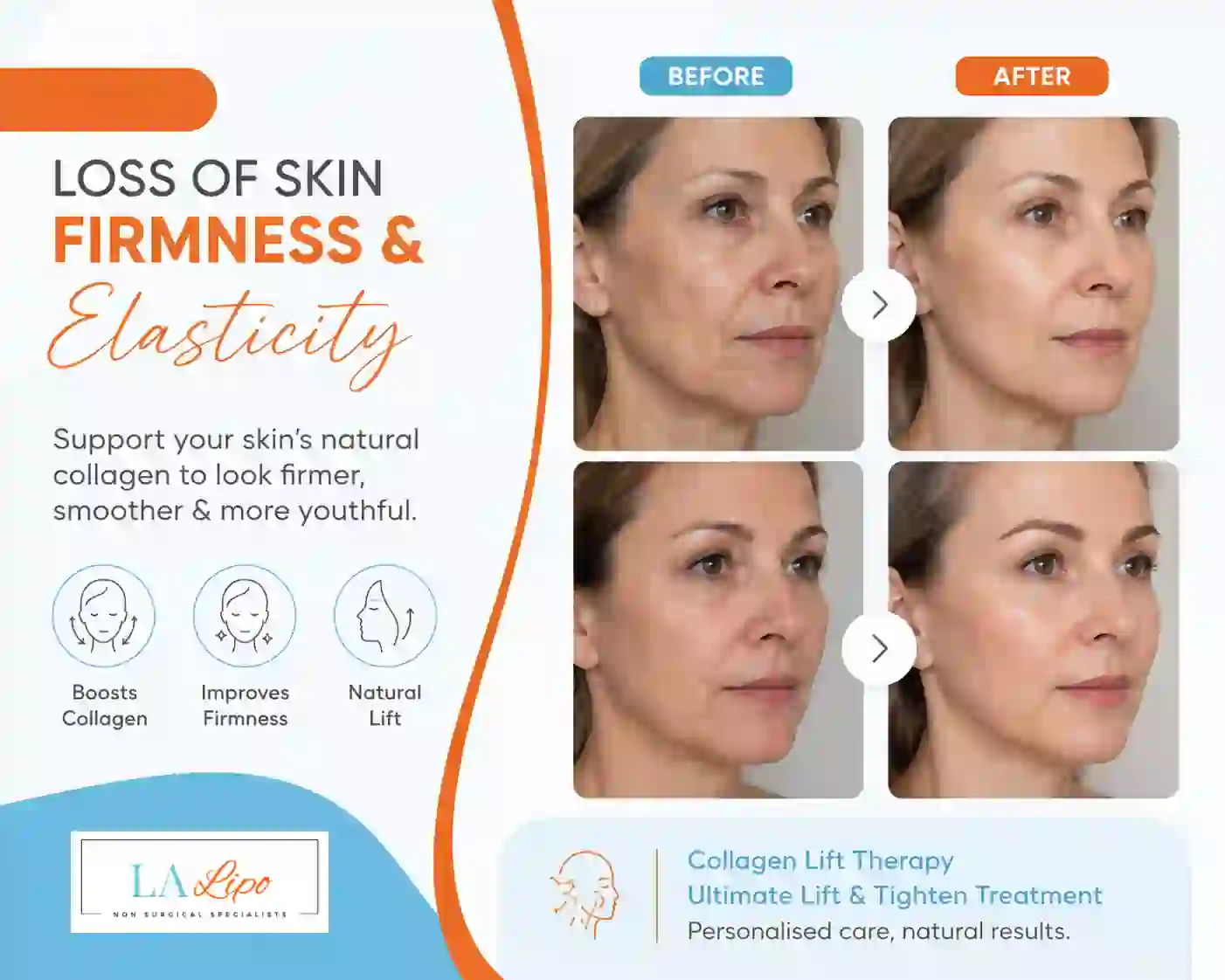 Sign #7: Loss of Skin Firmness and Elasticity Stratford